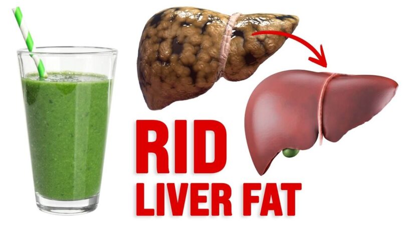 7 Foods To Avoid To Treat Fatty Liver