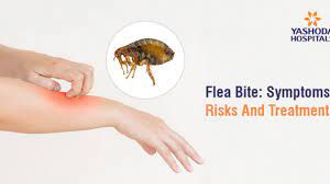 What do Flea Bites look like? Symptoms and Treatment