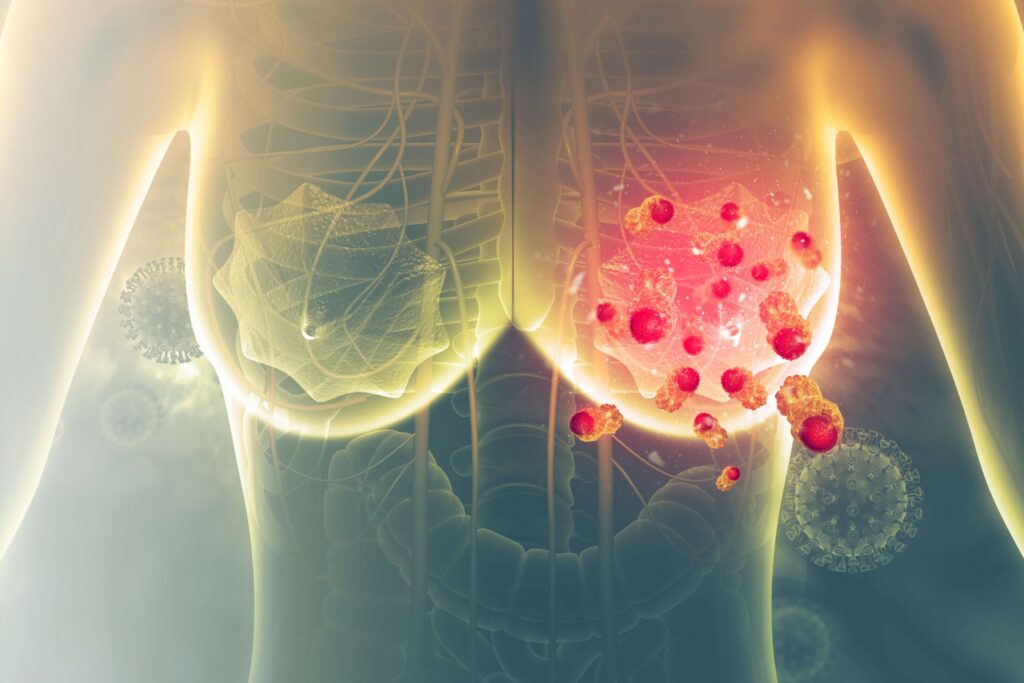 World Cancer Day 2023: Top 4 deadliest cancers in India and their symptoms as per oncologists.