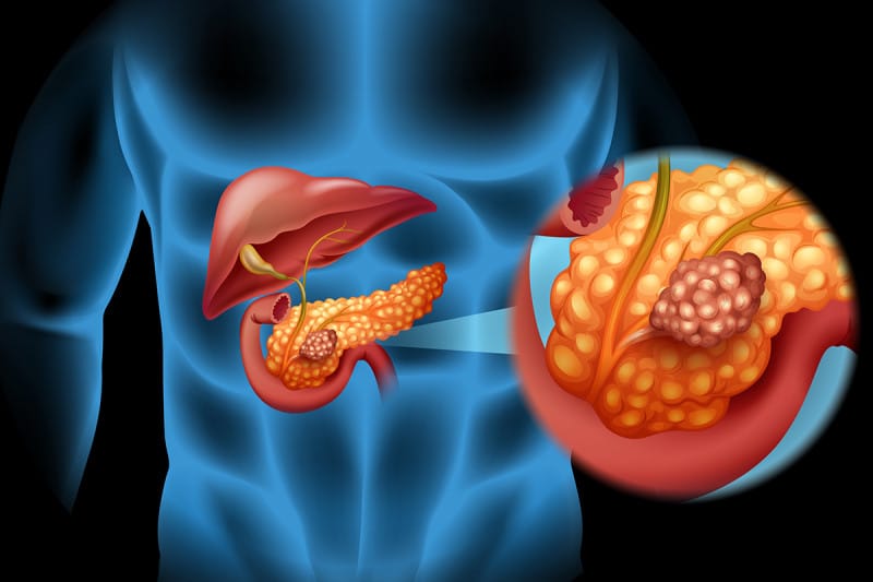 World Cancer Day 2023: Top 4 deadliest cancers in India and their symptoms as per oncologists.